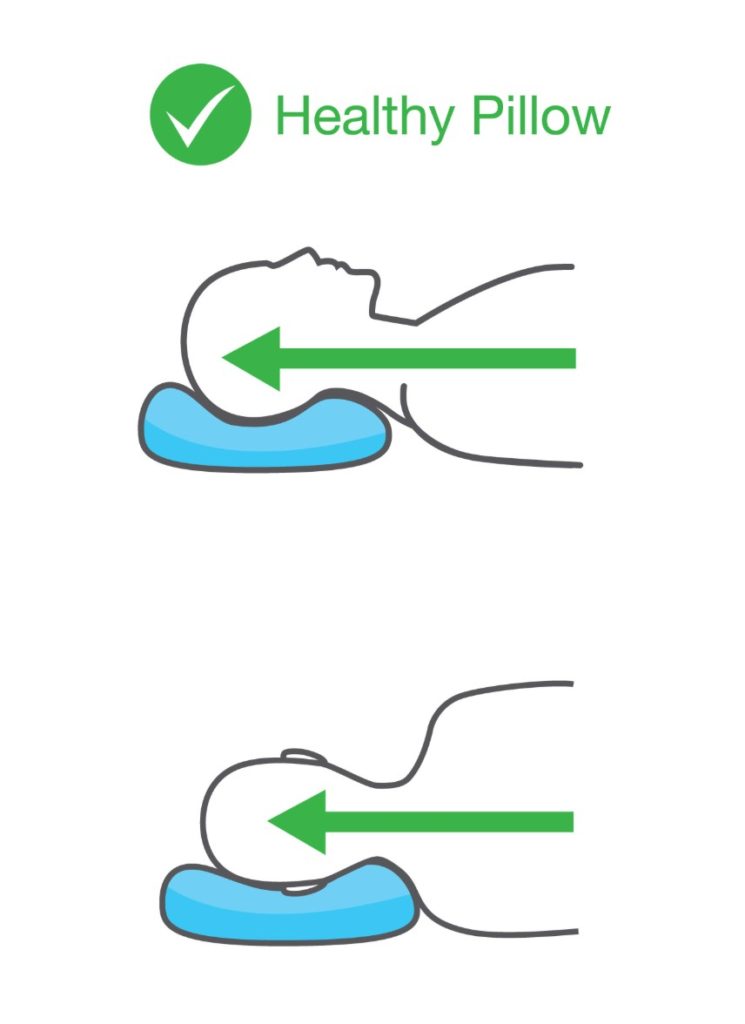 Vector illustration demonstrating the proper way to use a pillow to acheive proper spinal alignment.