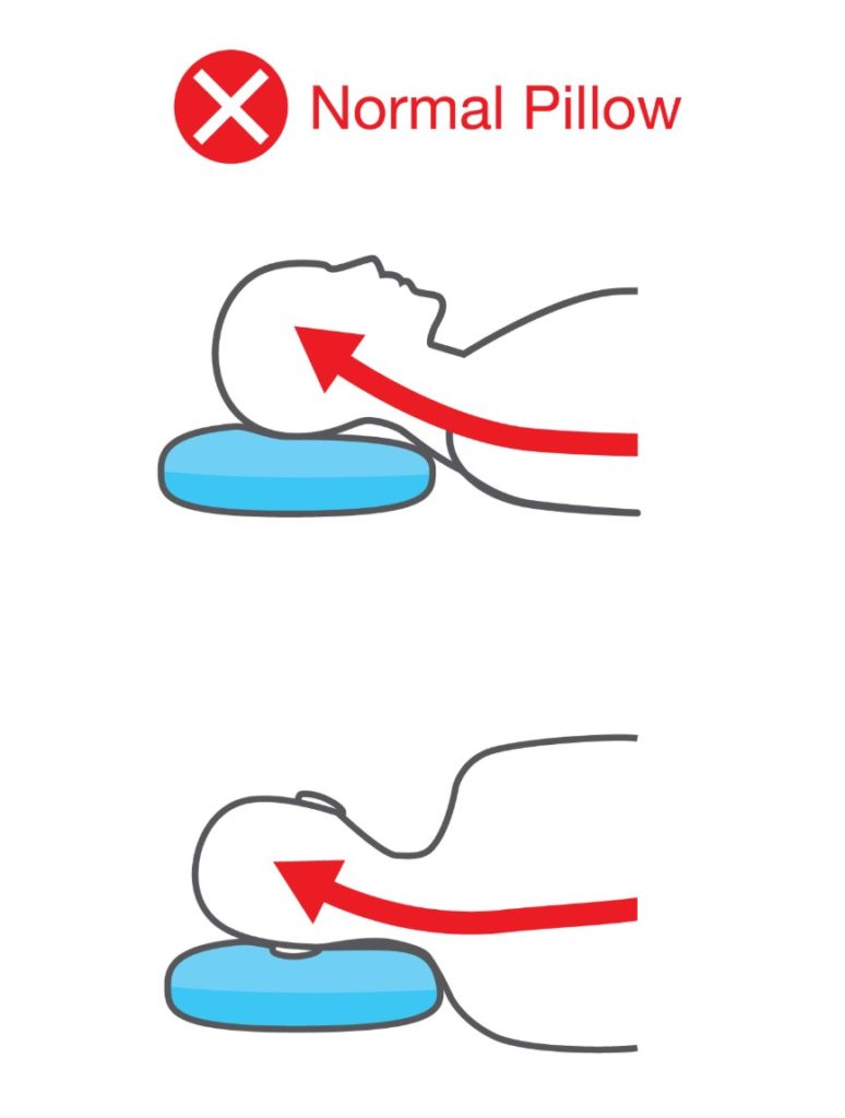 Vector illustration showing how traditional pillows do not support proper neck alignment.